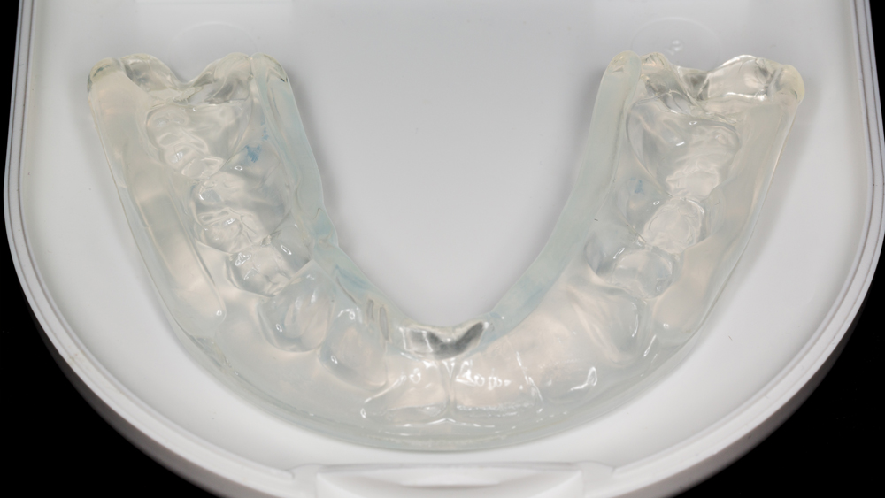 black dental model of the jaw with a bridge prosthesis and zirco